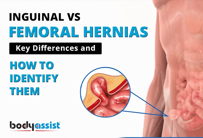 Key Differences and How to Identify Them