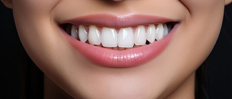 Transform Your Smile with Expert Dental Bonding in Mississauga