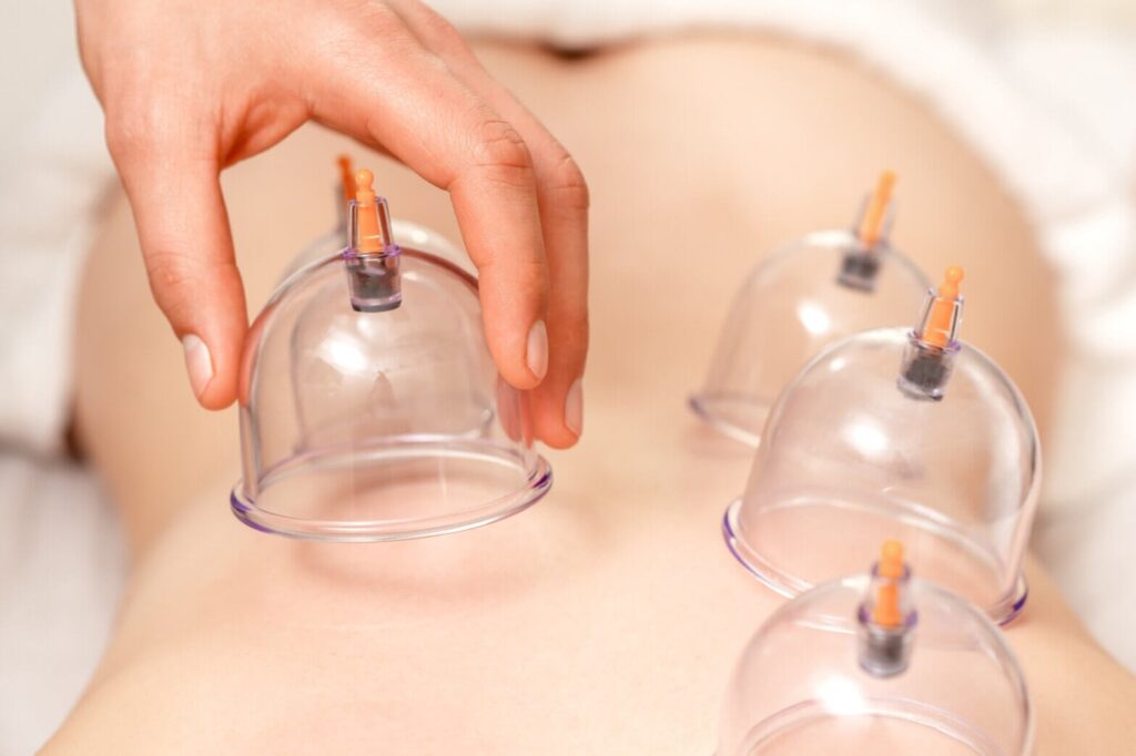 Discover the Real Results of Cupping Therapy and Ultrasonic Cavitation in Miami