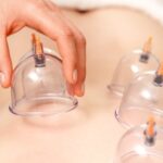 Discover the Real Results of Cupping Therapy and Ultrasonic Cavitation in Miami