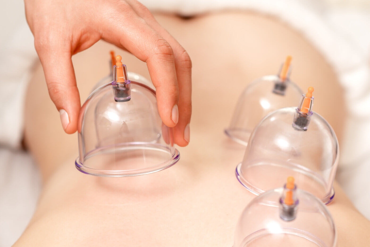 Discover the Real Results of Cupping Therapy and Ultrasonic Cavitation in Miami